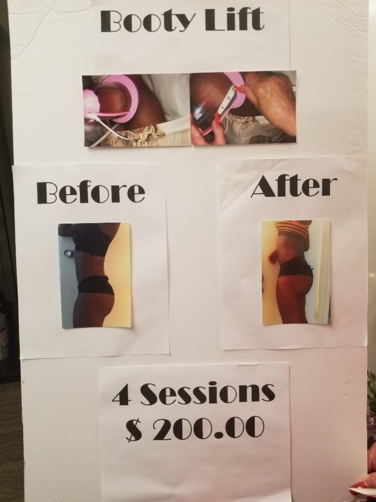 butt vacuum life before and after